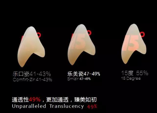 2017翔通醫(yī)療學術論壇&德派義齒《嵌體與貼面,理論與實操》 2017翔通醫(yī)療學術論壇&德派義齒《嵌體與貼面,理論與實操》