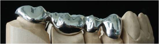 3D打印在齒科不得不說的秘密 3D打印在齒科不得不說的秘密