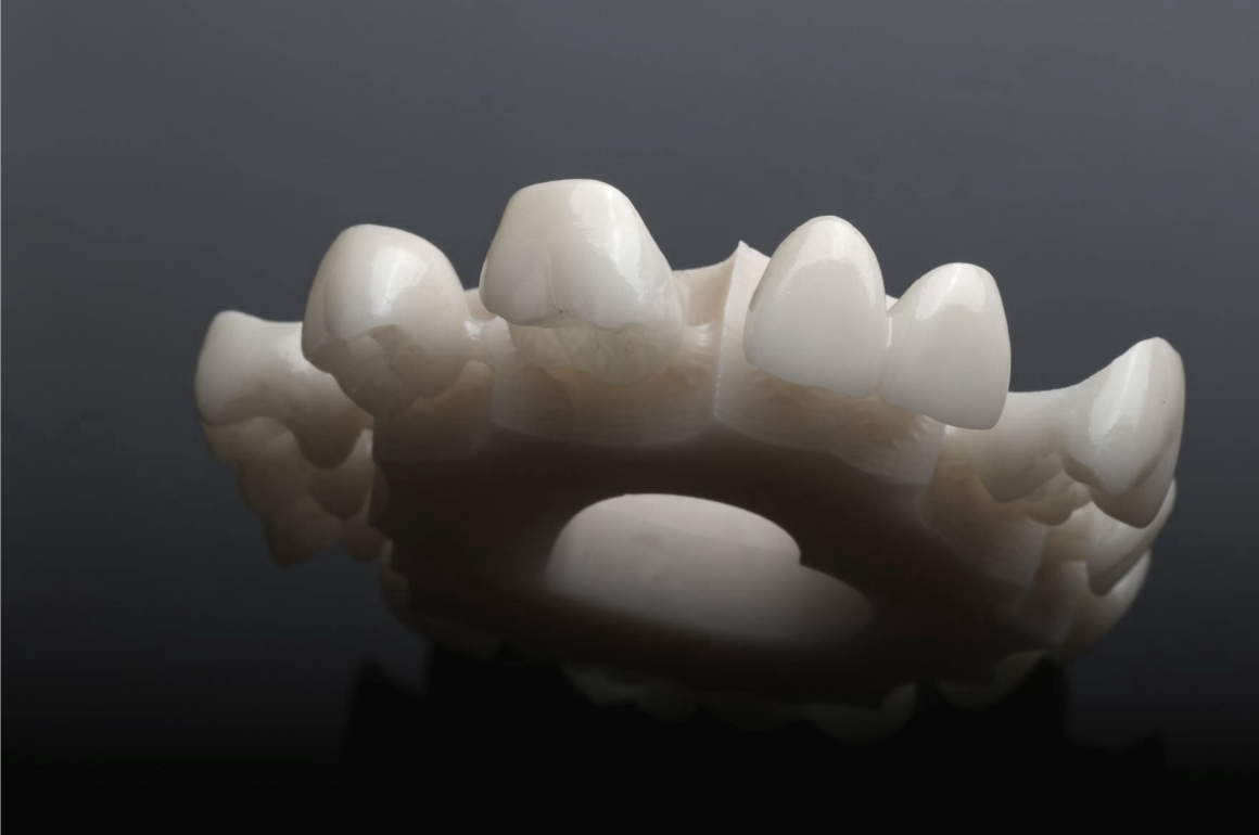 XTCERA 3D White XTCERA 3D White