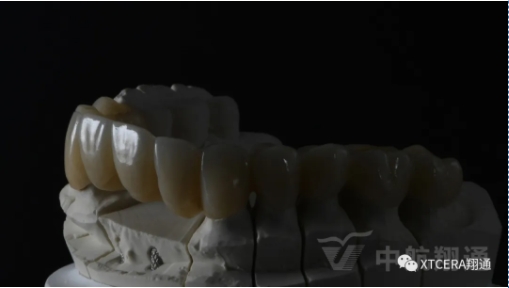 前牙?次修復(fù)氧化鋯美容冠修復(fù)病例分享 前牙?次修復(fù)氧化鋯美容冠修復(fù)病例分享