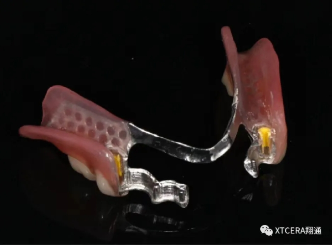 全口氧化鋯美學修復臨床病例分享 全口氧化鋯美學修復臨床病例分享