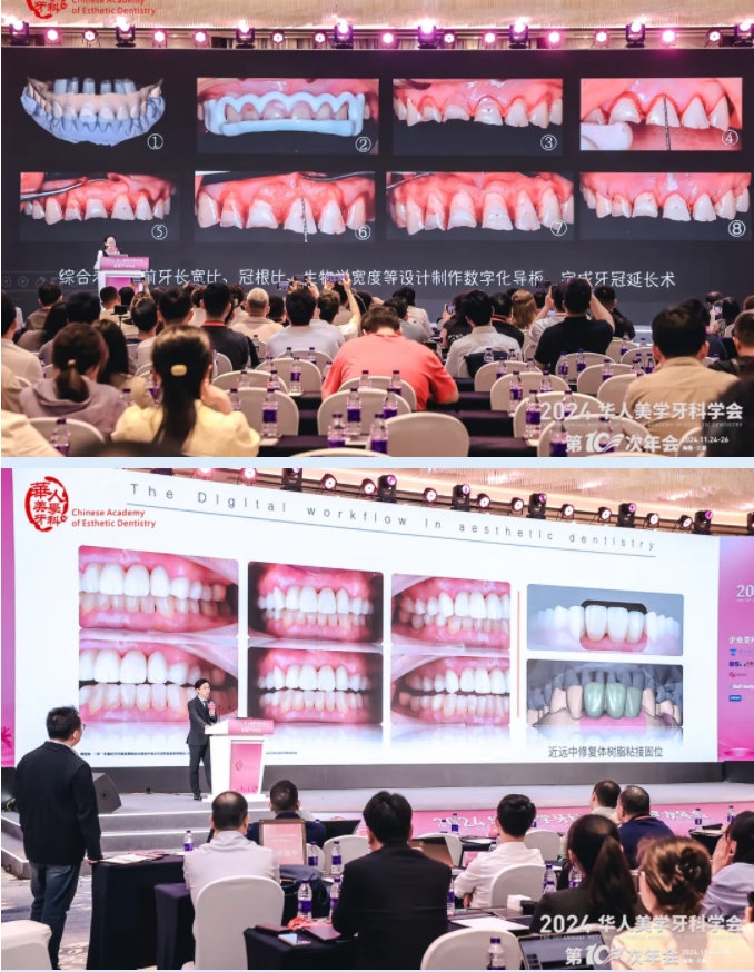共襄美學(xué)盛宴 | 華人美學(xué)牙科學(xué)會(huì)第10次年會(huì)圓滿收官! 共襄美學(xué)盛宴 | 華人美學(xué)牙科學(xué)會(huì)第10次年會(huì)圓滿收官!