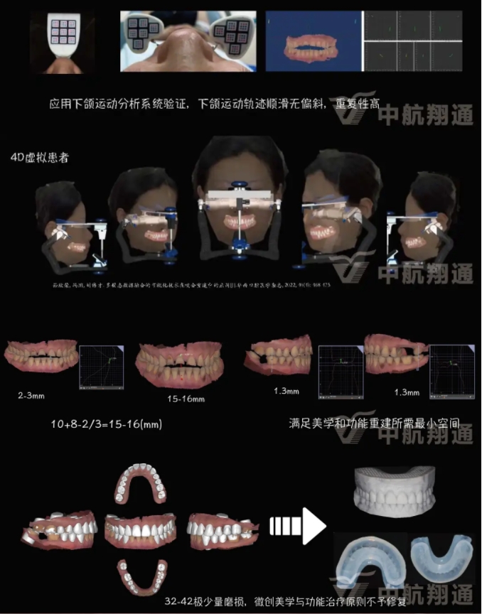 2024華人美學(xué)臨床病例大賽獲獎病例|數(shù)字化輔助牙列重度磨耗的美學(xué)和功能重建一例