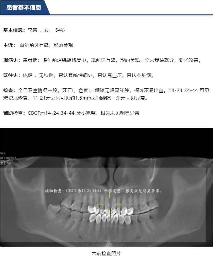 前牙全瓷美學(xué)修復(fù)臨床病例分享