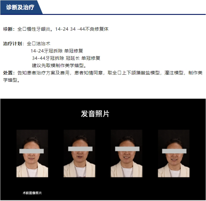 前牙全瓷美學(xué)修復(fù)臨床病例分享
