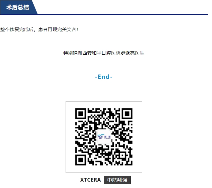 前牙全瓷美學(xué)修復(fù)臨床病例分享