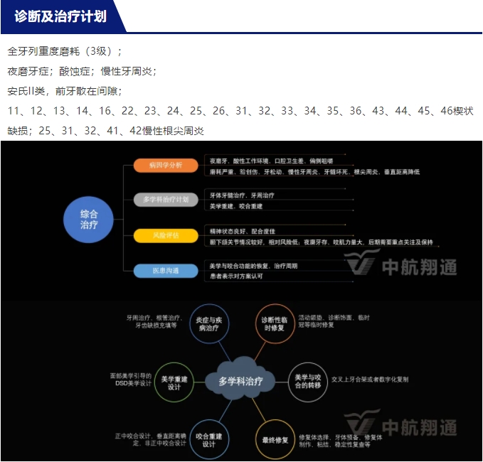 2024華人美學(xué)臨床病例大賽獲獎病例|以美學(xué)設(shè)計為導(dǎo)向的牙列重度磨耗患者全牙列咬合重建