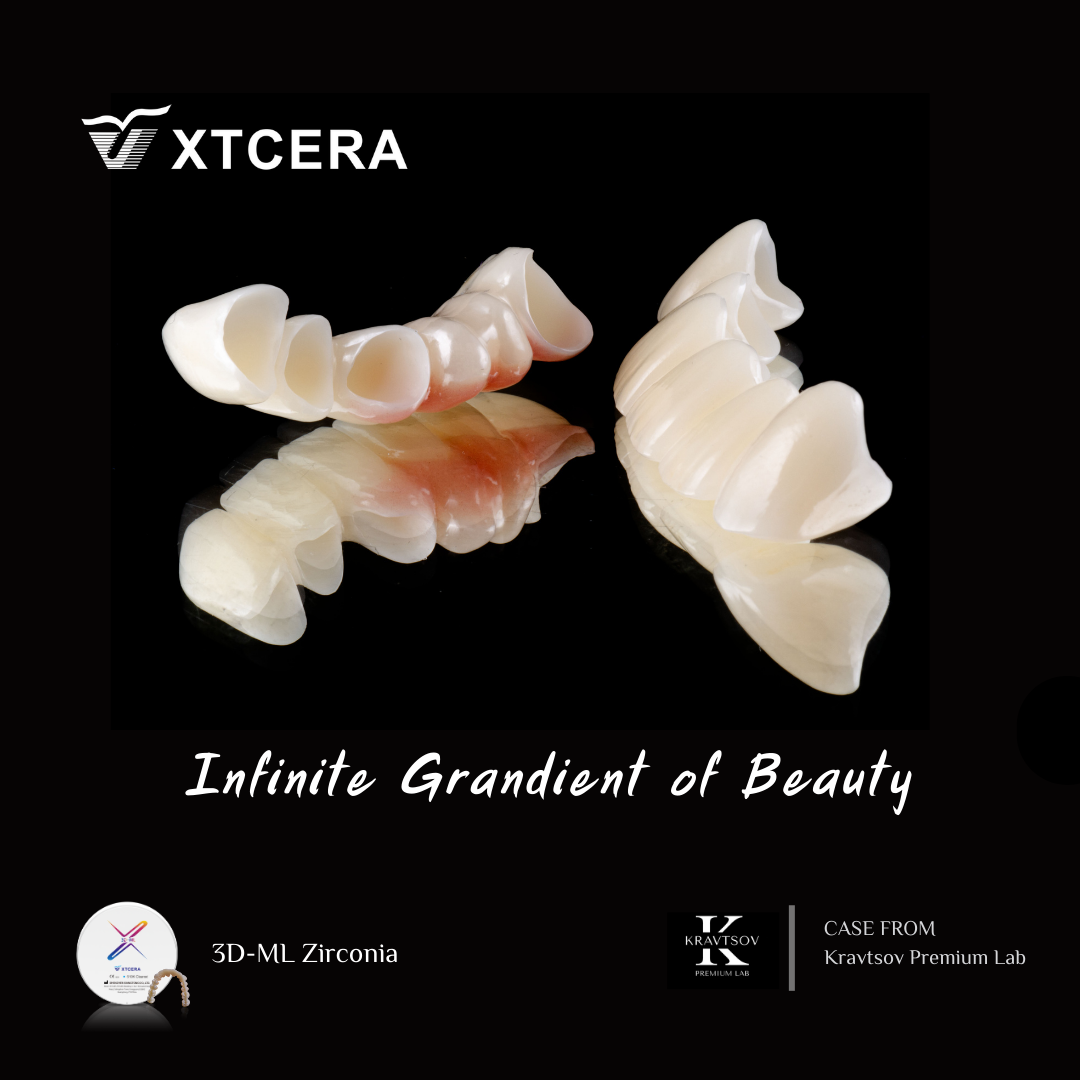 中航翔通3D ML Zirconia|匠心臻選·定制級美學修復