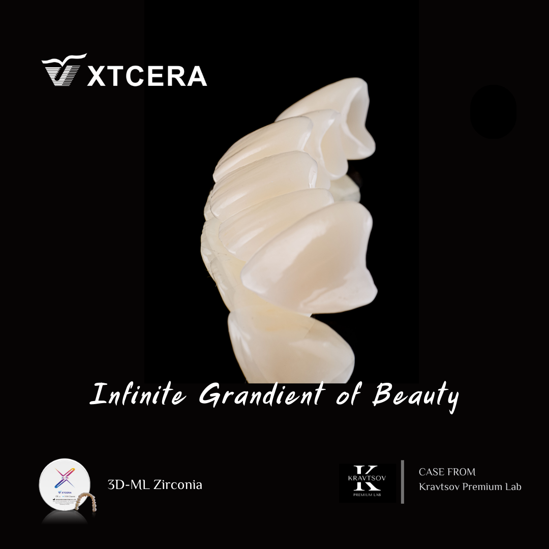 中航翔通3D ML Zirconia|匠心臻選·定制級美學修復
