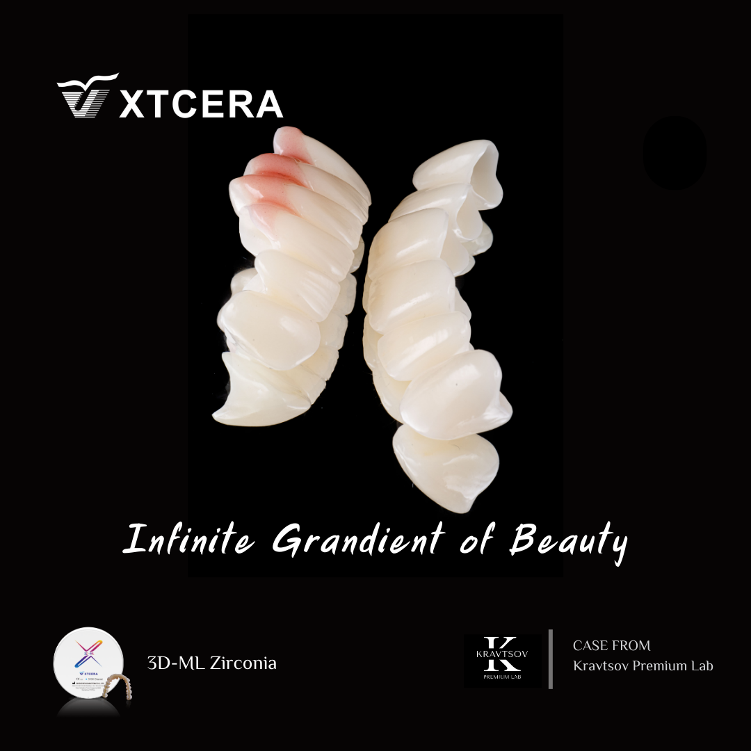 中航翔通3D ML Zirconia|匠心臻選·定制級美學修復