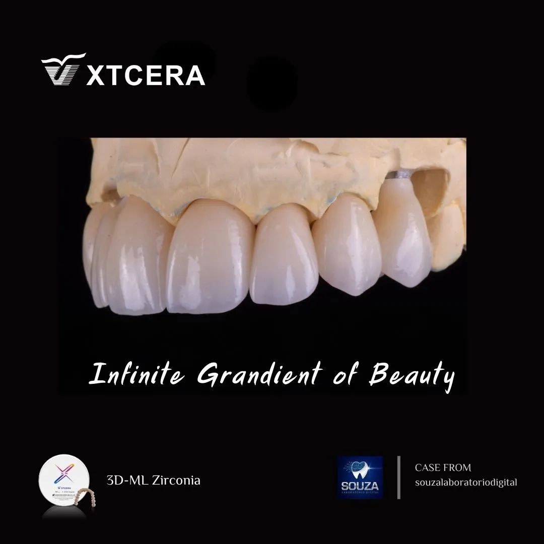 中航翔通3D ML Zirconia|匠心臻選·定制級(jí)美學(xué)修復(fù)
