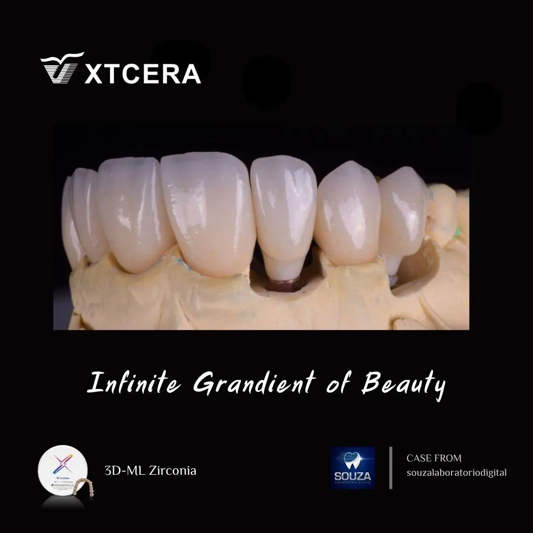 中航翔通3D ML Zirconia|匠心臻選·定制級(jí)美學(xué)修復(fù)